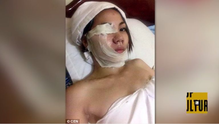 Karma: Girl Tries to Pour Acid on Ex’s Face, Wind Blows It Onto Hers Instead